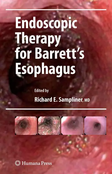 Cover of Endoscopic Therapy for Barretts Esophagus
