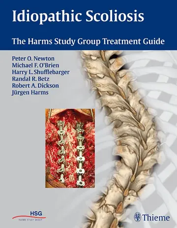 Cover of Idiopathic Scoliosis