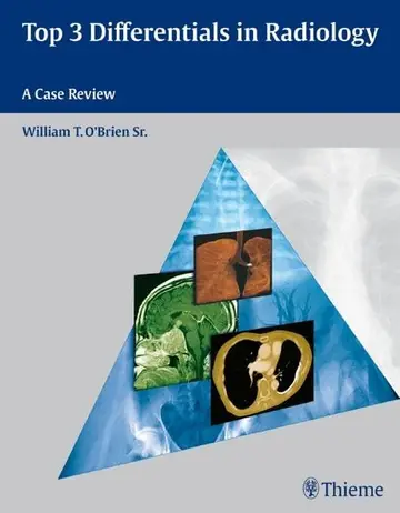 Cover of Top 3 Differentials in Radiology