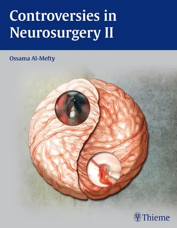 Cover of Controversies in Neurosurgery 2