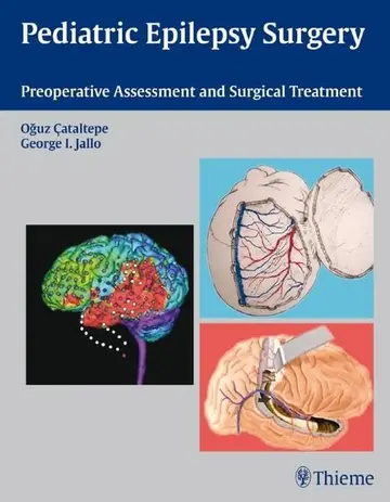 Cover of Pediatric Epilepsy Surgery