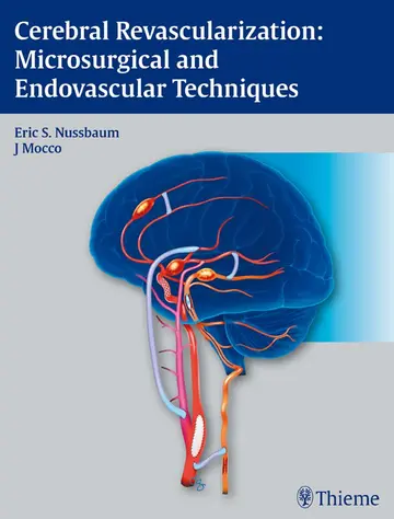 Cover of Cerebral Revascularization Microsurgical and Endov