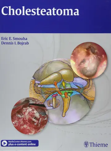 Cover of Cholesteatoma