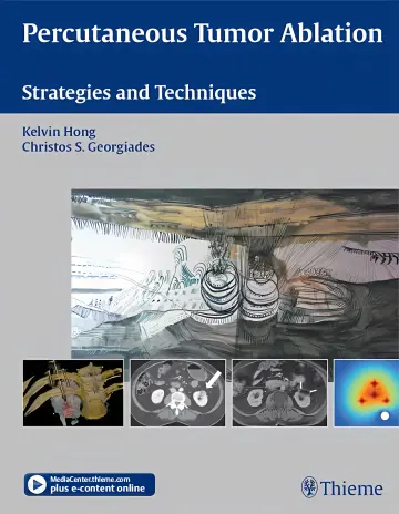 Cover of Percutaneous Tumor Ablation