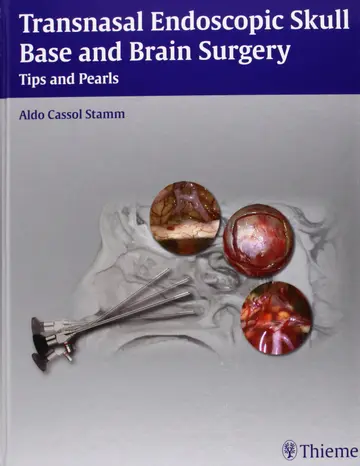 Cover of Transnasal Endoscopic Skull Base and Brain Surgery