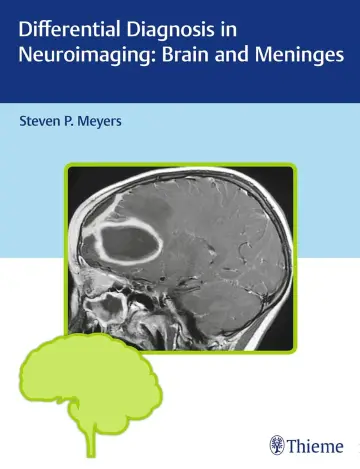 Cover of Differential Diagnosis in Neuroimaging