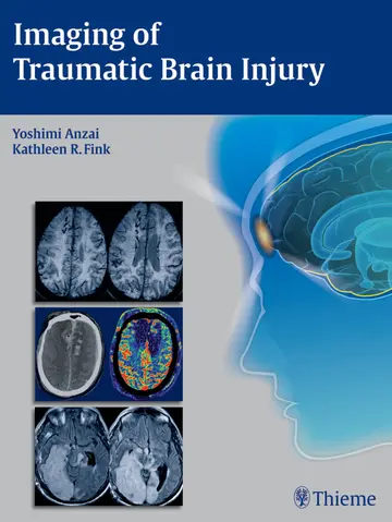 Cover of Imaging of Traumatic Brain Injury