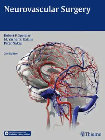 Cover of Neurovascular Surgery