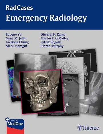 Cover of Radcases Emergency Radiology (Radcases Plus Q&A) 1
