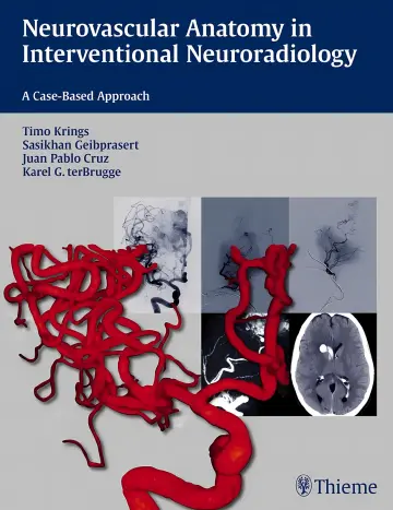 Cover of Neurovascular Anatomy in Interventional Neuroradiology
