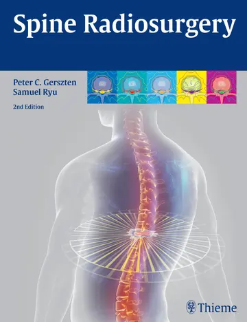 Cover of Controversies in Stereotactic Radiosurgery