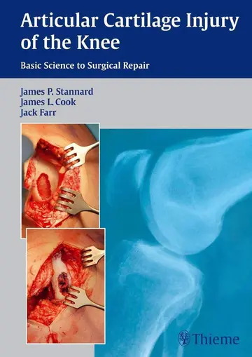 Cover of Articular Cartilage Injury of the Knee