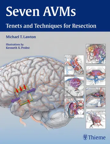 Cover of Seven AVMs