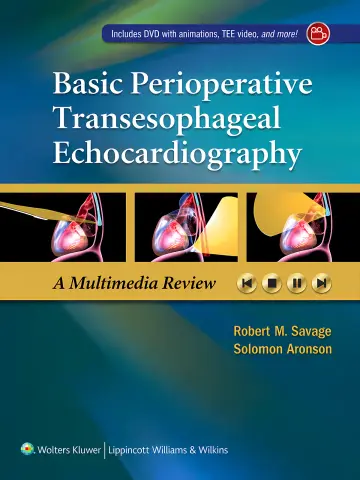 Cover of Basic Perioperative Transesophageal Echocardiography