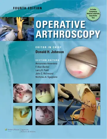 Cover of Operative arthroscopy