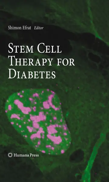 Cover of Stem Cell Therapy for Diabetes