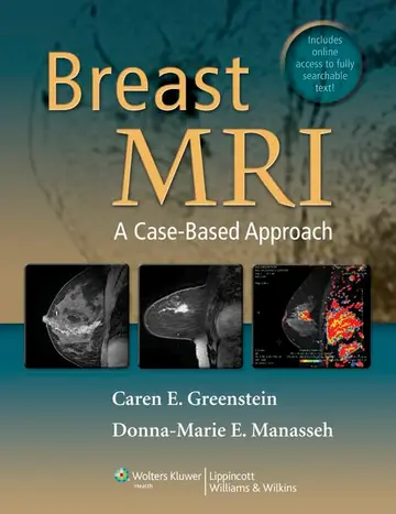Cover of Breast Mri A Case Based Approach