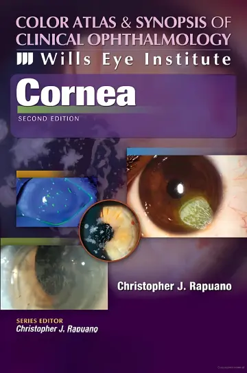 Cover of Cornea