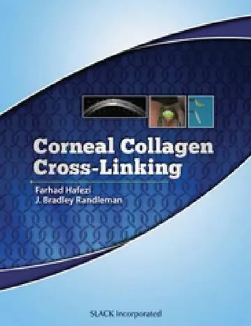 Cover of Corneal Collagen Cross Linking