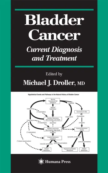 Cover of Bladder Cancer