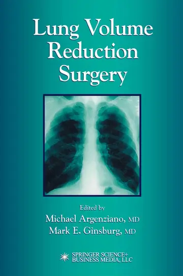 Cover of Lung Volume Reduction Surgery