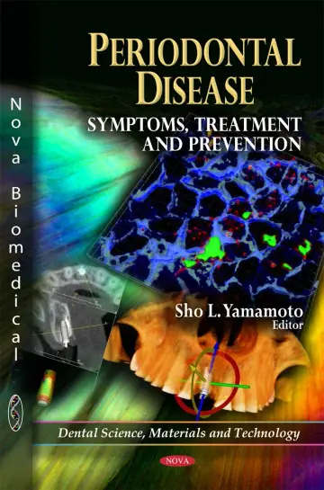 Cover of Periodontal Disease