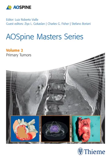 Cover of Aospine Masters Series Primary Spinal Tumors Vol 2