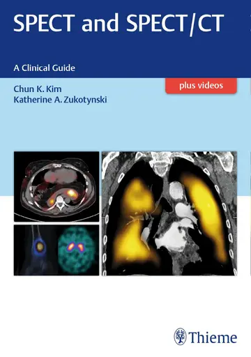 Cover of Spect and Spect/Ct