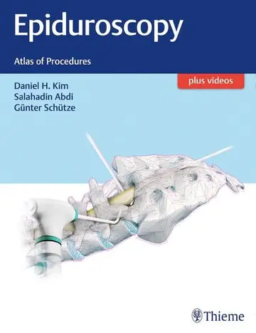 Cover of Epiduroscopy
