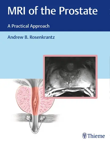 Cover of MRI of the Prostate