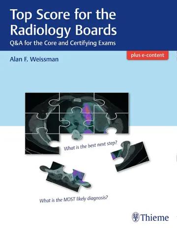 Cover of Top Score for the Radiology Boards