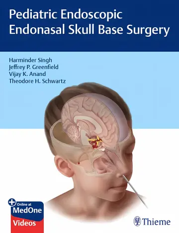 Cover of Pediatric Endoscopic Endonasal Skull Base Surgery