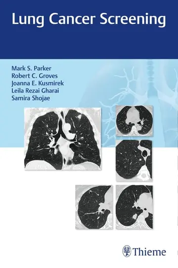 Cover of Lung Cancer Screening