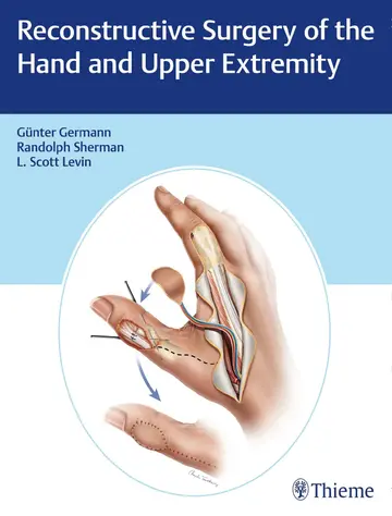 Cover of Reconstructive Surgery of the Hand and Upper Extremity
