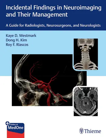 Cover of Incidental Findings in Neuroimaging and Their Management