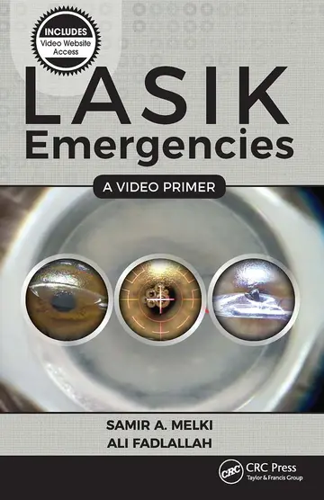 Cover of LASIK Emergencies