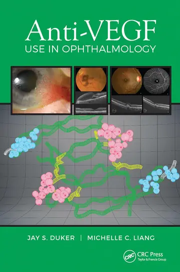 Cover of Anti-VEGF Use in Ophthalmology