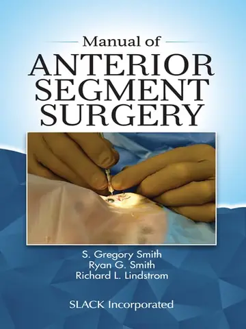 Cover of Manual of Anterior Segment Surgery