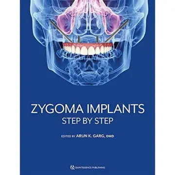 Cover of Zygoma Implants