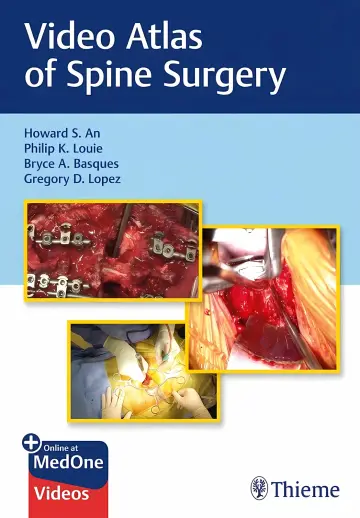 Cover of Video Atlas of Spine Surgery Illustrated
