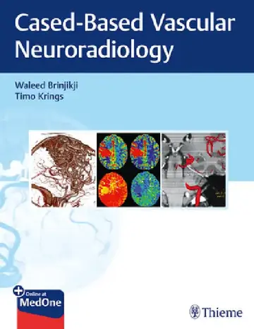 Cover of Imaging in Neurovascular Disease