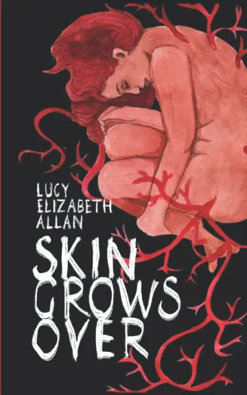 Cover of Skin Grows Over