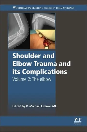 Cover of Shoulder and Elbow Trauma and Its Complications