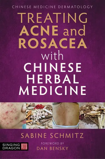 Cover of Treating Acne and Rosacea with Chinese Herbal Medicine