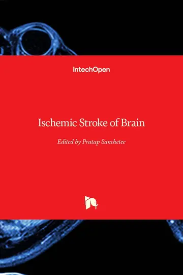 Cover of Ischemic Stroke of Brain
