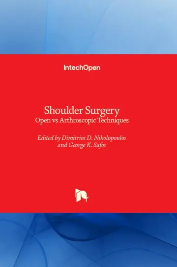 Cover of Shoulder Surgery