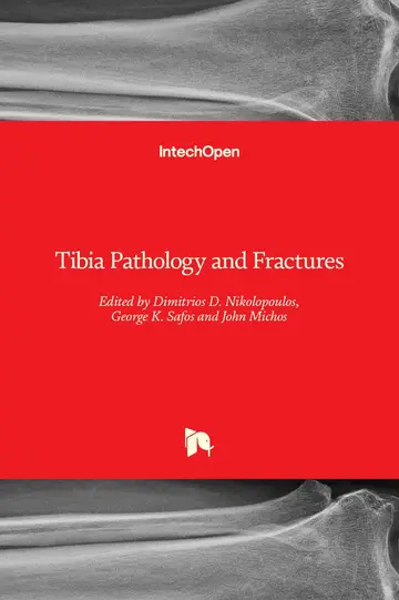 Cover of Tibia Pathology and Fractures