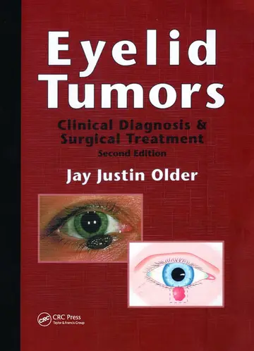 Cover of Eyelid Tumors 2/e