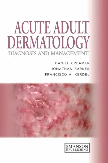 Cover of A Colour Handbook of Acute Adult Dermatology