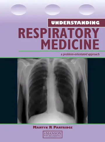 Cover of Understanding Respiratory Medicine